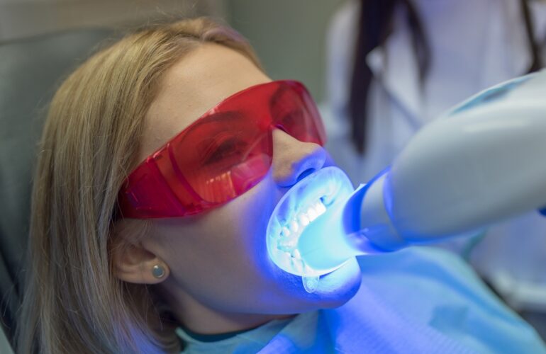 La Tecnología en el Blanqueamiento Dental: Revolucionando Sonrisas
