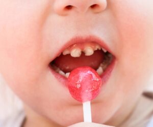 ¿Cómo Prevenir las Caries en los Dientes de Leche?