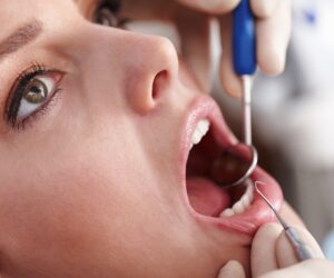 Limpieza Dental Profesional: Todo lo que Necesitas Saber